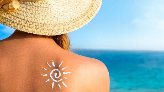 Sunburns & Home Remedies